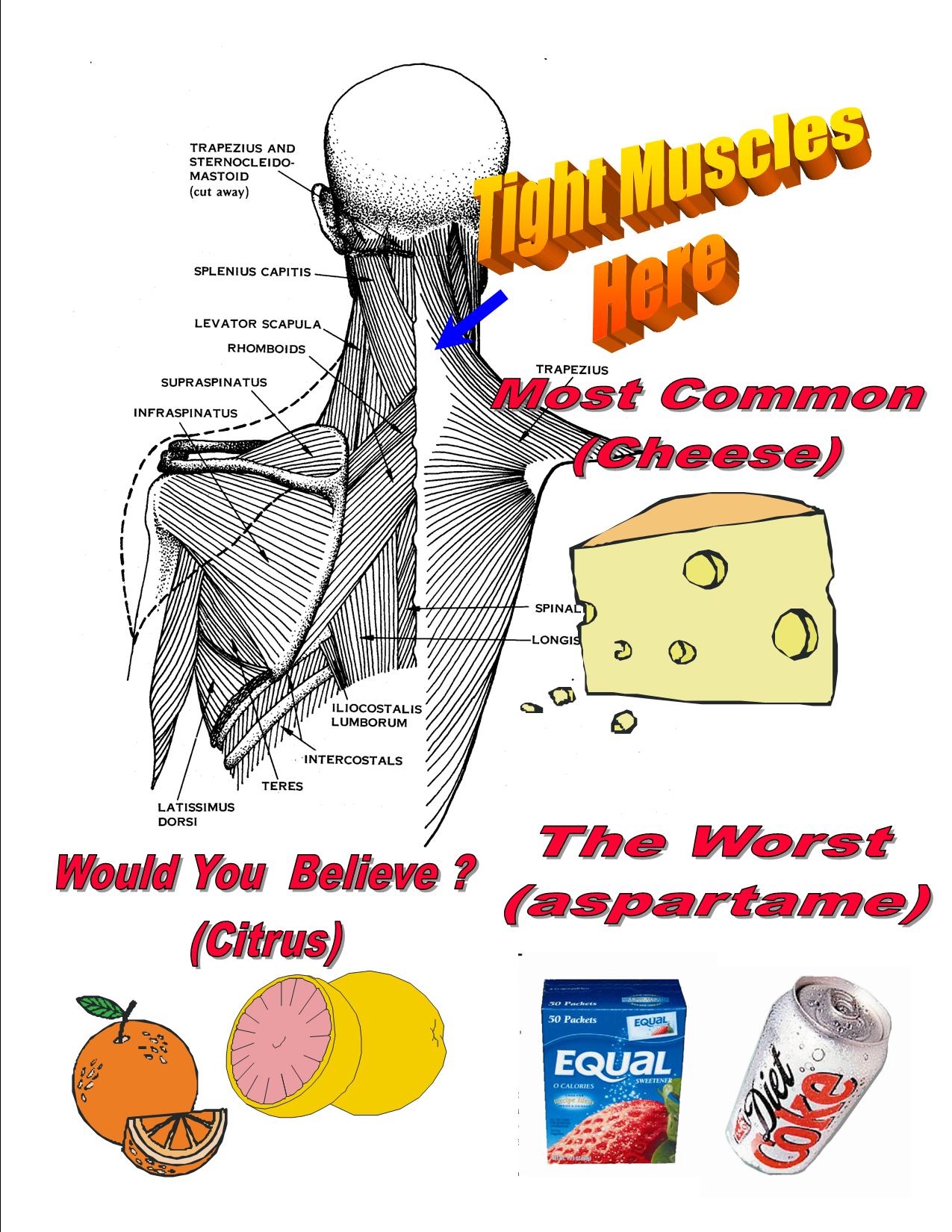 Neck pain